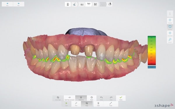 SP】審美歯科 | 滋賀県草津市/南草津【十禅歯科クリニック】歯医者